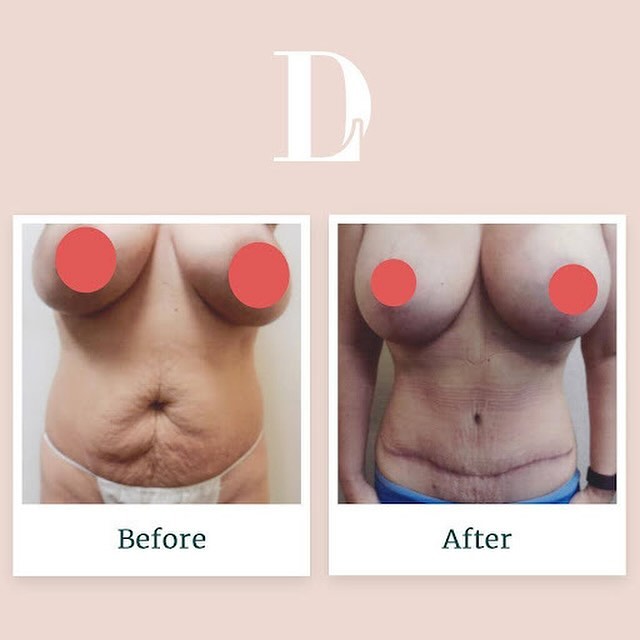 Instagram post by David Liland MD