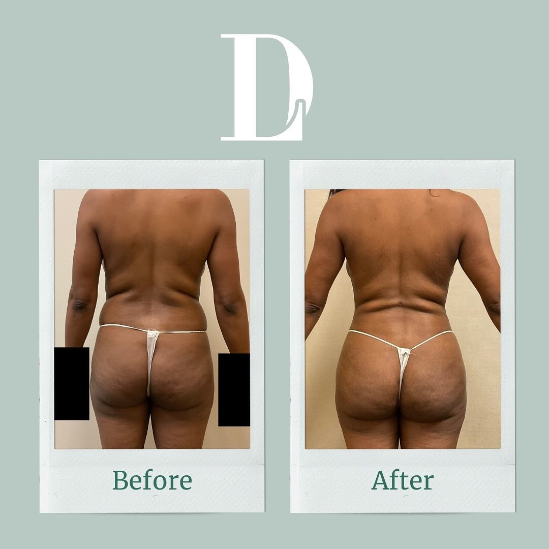 Instagram post by David Liland MD