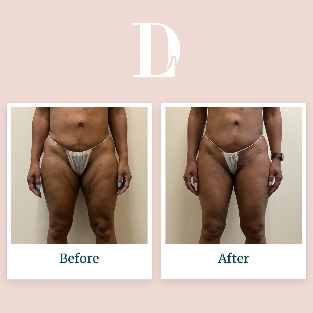 Instagram post by David Liland MD