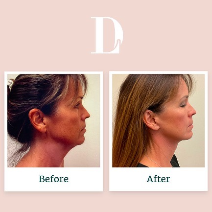 Instagram post by David Liland MD