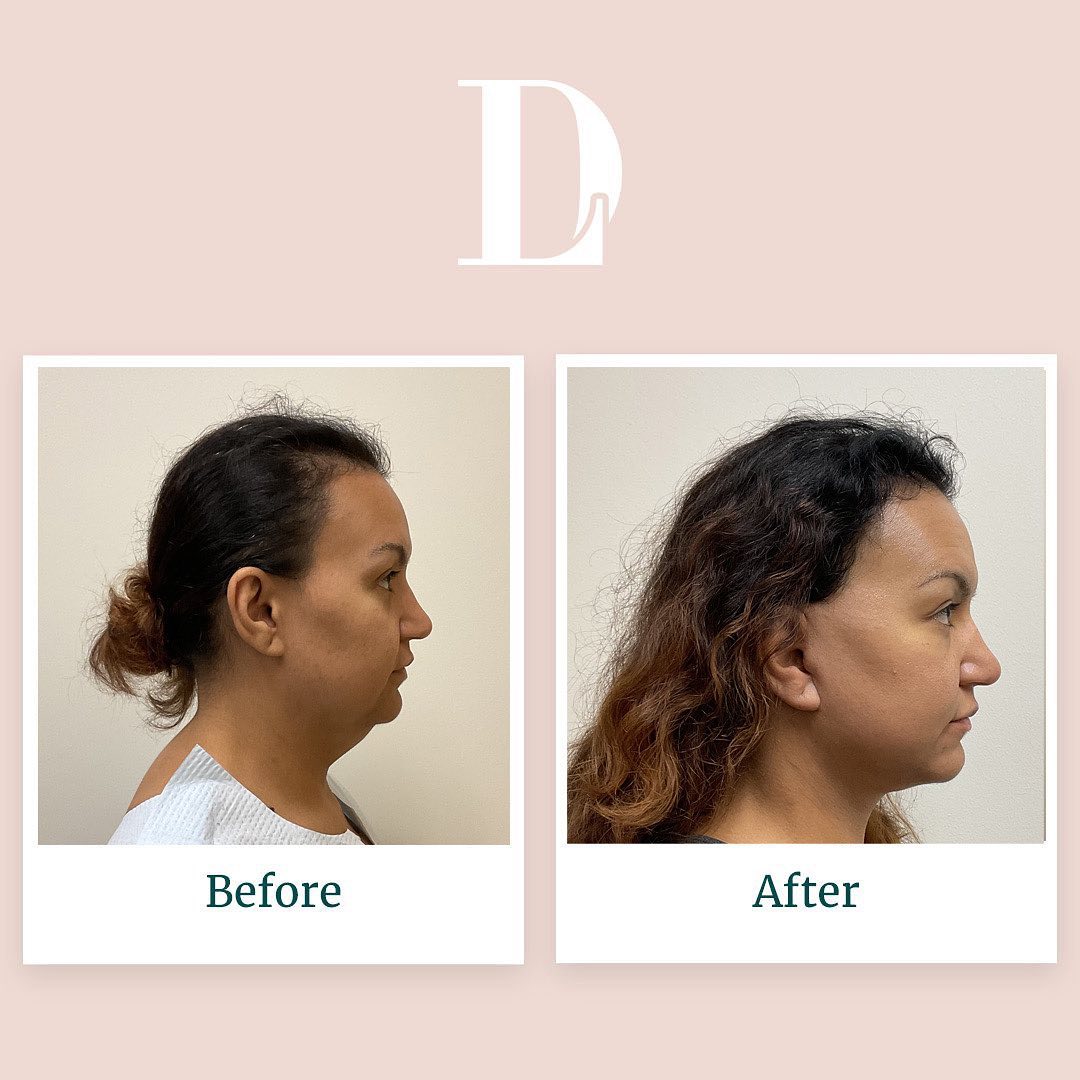 Instagram post by David Liland MD