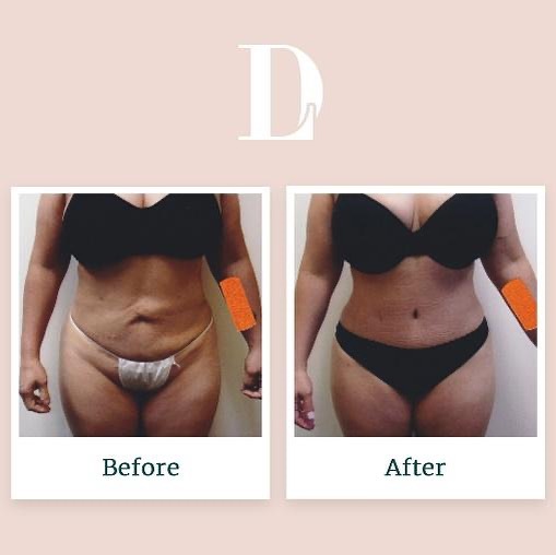 Instagram post by David Liland MD